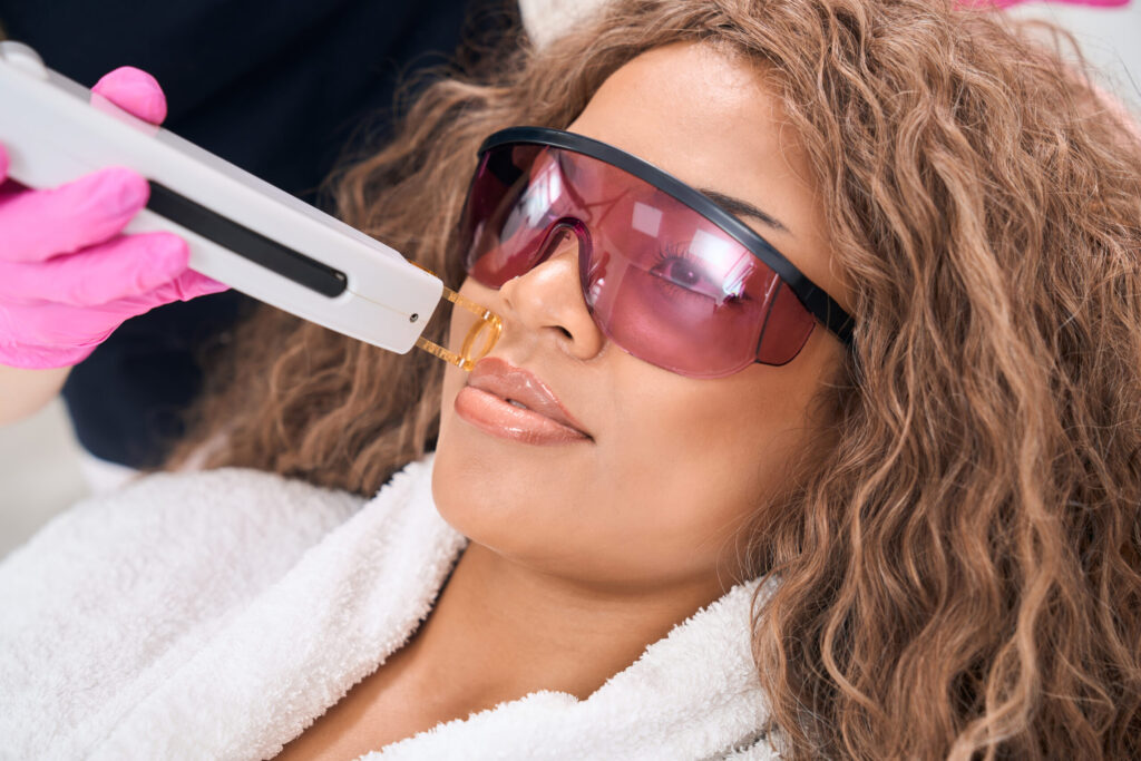 woman on mustache laser hair removal procedure 2022 09 02 04 37 38 utc scaled