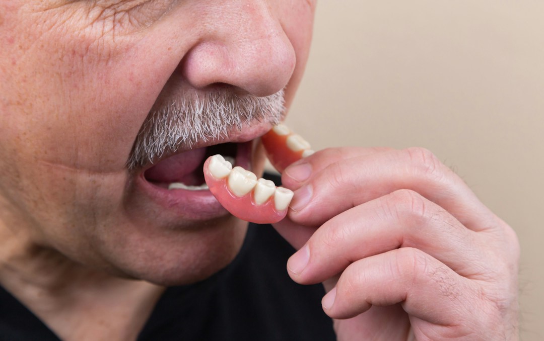 3 of the Most Common Dental Conditions and How To Treat Them 4 img