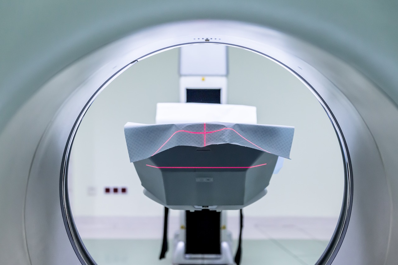 3 Reasons Why MRI Should Replace CT for Whole Body Screening 1 MRI
